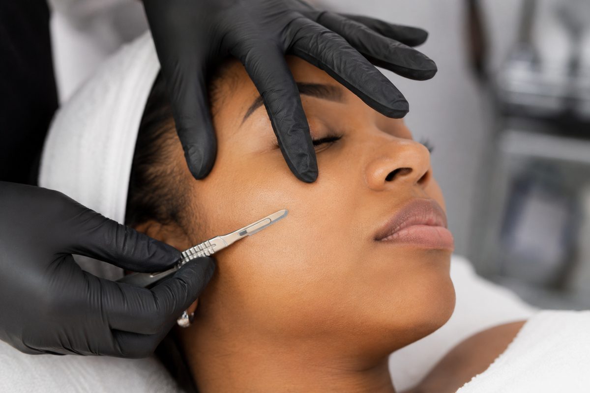 Dermaplaning treatment with a sterile blade on a client's cheek